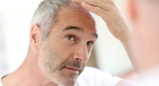 Hair Transplant Side Effects Which You Must Be Aware Of!