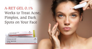 A Ret Gel Is the Best-Selling Generic Acne Drug on PharmaExpressRx