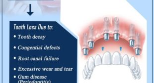 Invisalign braces teeth treatment in chennai